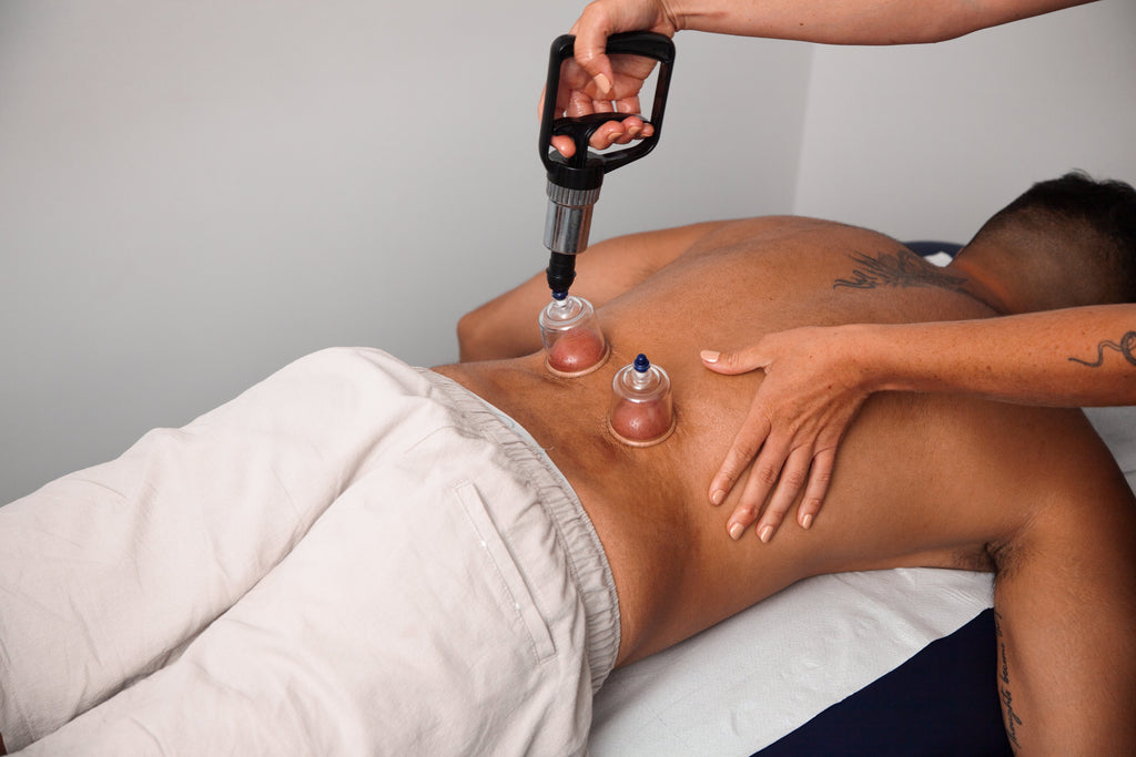 The Benefits of Cupping Therapy in Physiotherapy: How It Can Aid Your Recovery